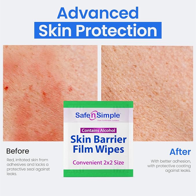 Safe n' Simple Skin Barrier Wipe - Image 7