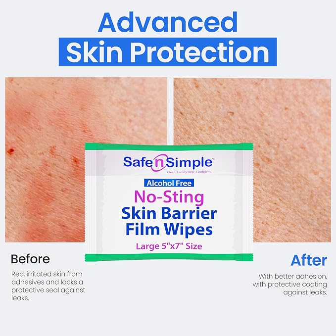 Safe n' Simple Skin Barrier Wipes - Image 7