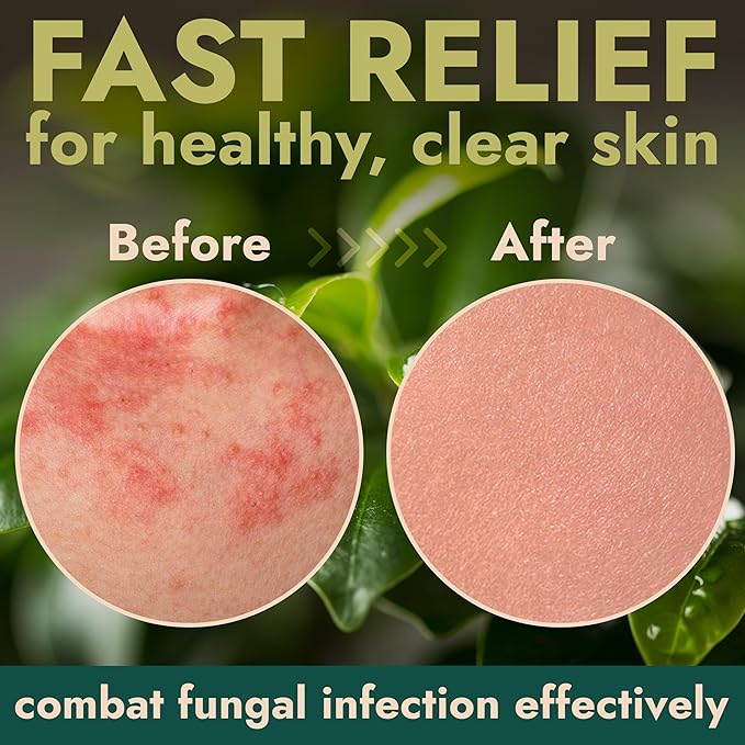 Body Spray with Tea Tree Oil | Fast-Absorbing Antifungal Treatment - Image 5