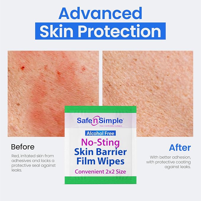 Safe n' Simple No Sting Skin Prep Wipes - Image 7