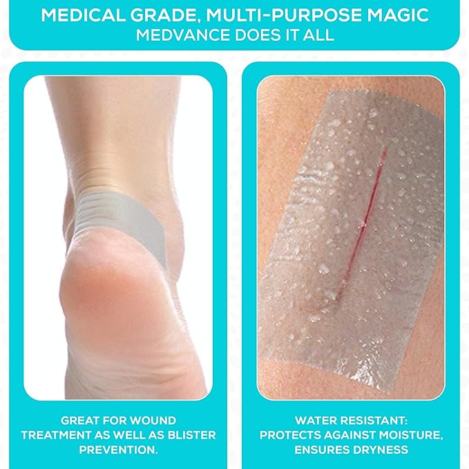 Medvance Cuttable Soft Silicone Tape - Image 6